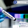 ABO Group Testing