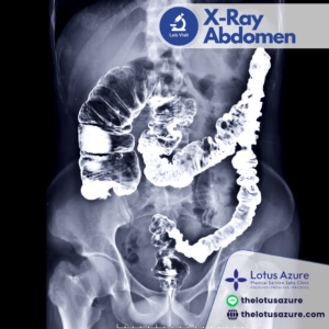 Abdomen X-ray(ช่องท้อง)